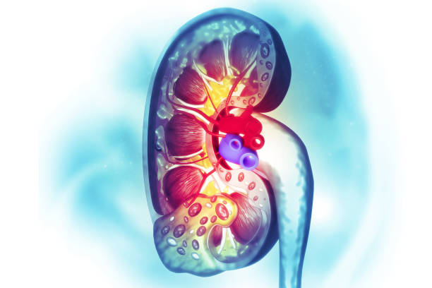 تضيق الشريان الكلوي