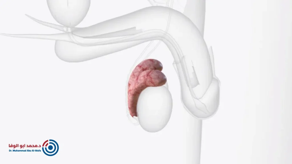 هل تؤثر دوالي الخصية على الانتصاب