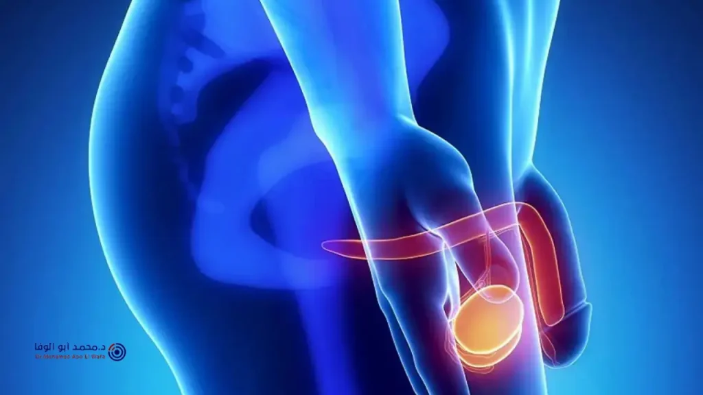 شفيت من دوالي الخصية بدون جراحة